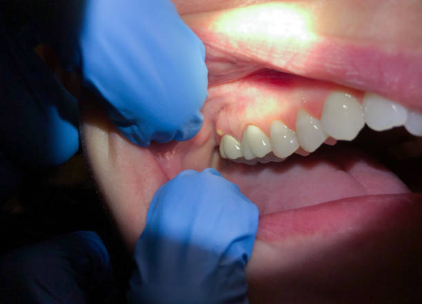 Urgent Tooth Repair in NE